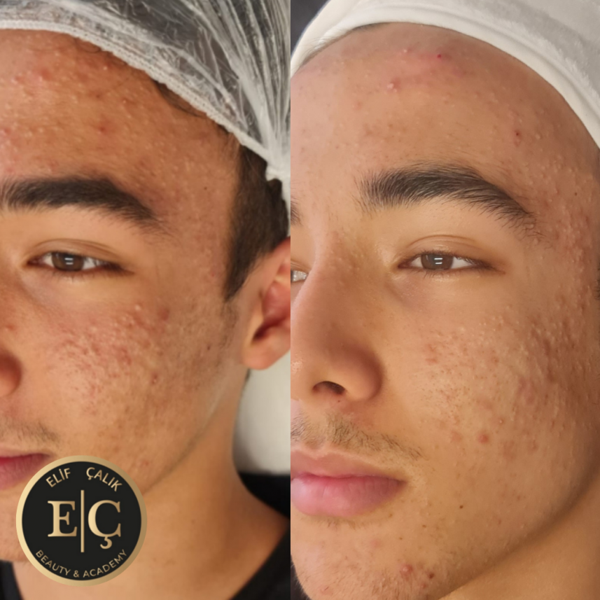 Elif Çalık Beauty & Academy