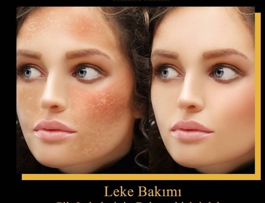 Estesera Estetik&Güzellik
