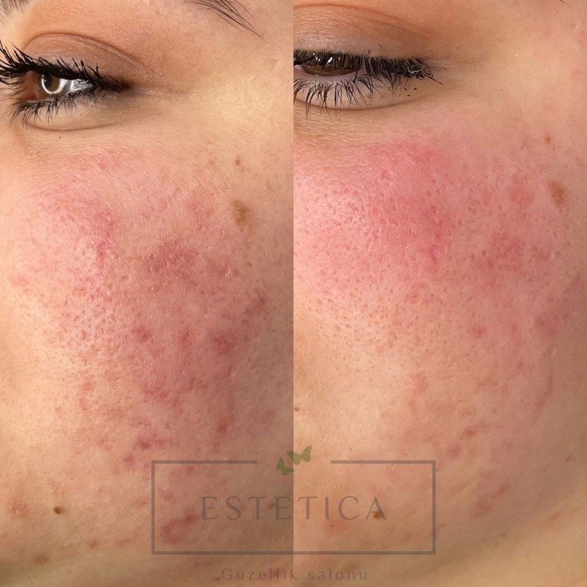 Estetica Güzellik Salonu 