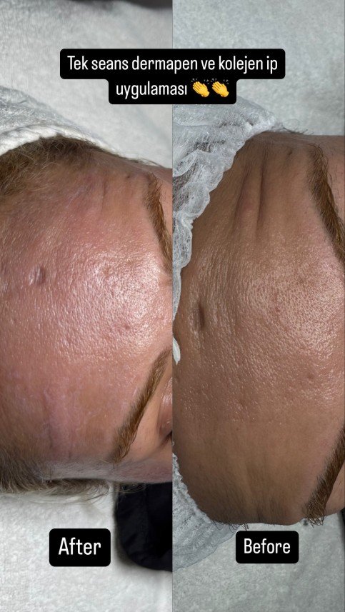 Funda Yücel akdeniz