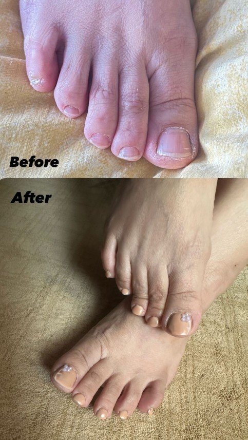 İdil Protez Tırnak