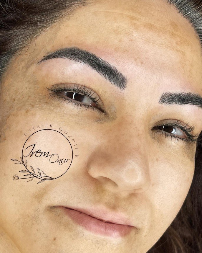İrem Onur Estetik Güzellik 