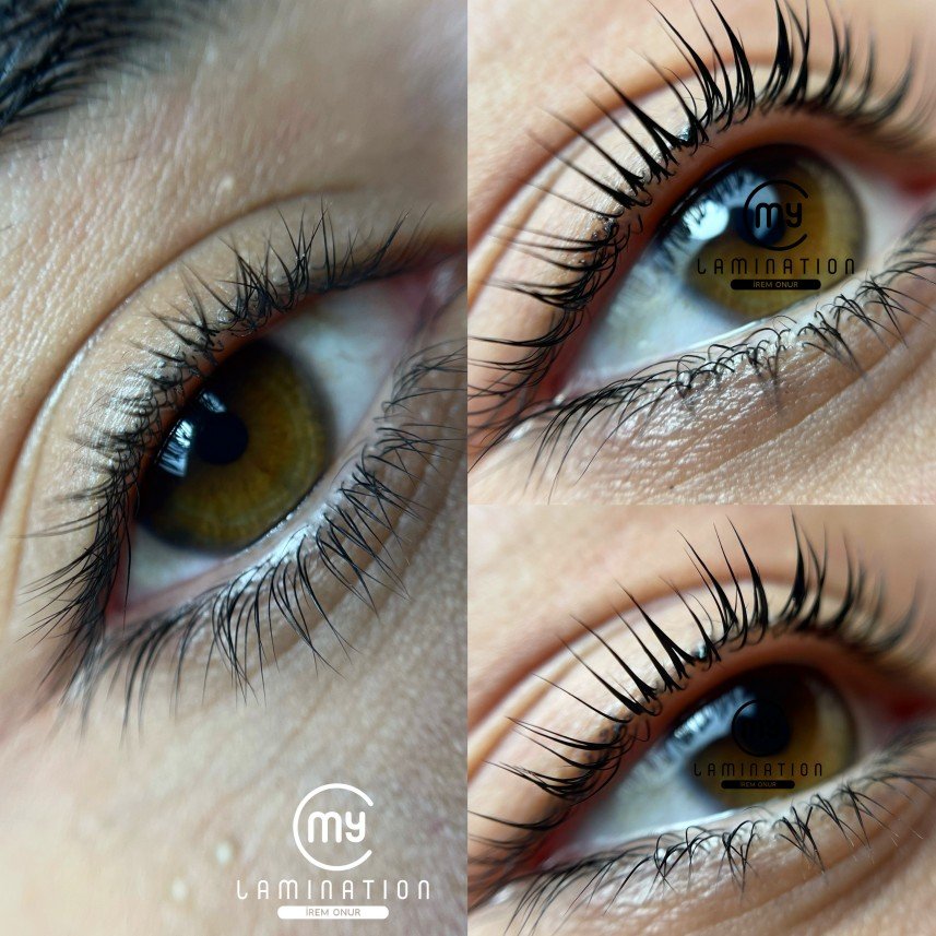 İrem Onur Estetik Güzellik 