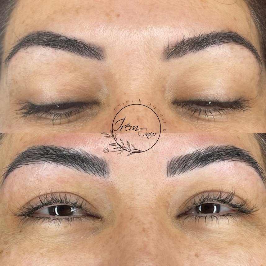 İrem Onur Estetik Güzellik 