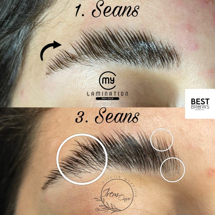 İrem Onur Estetik Güzellik 