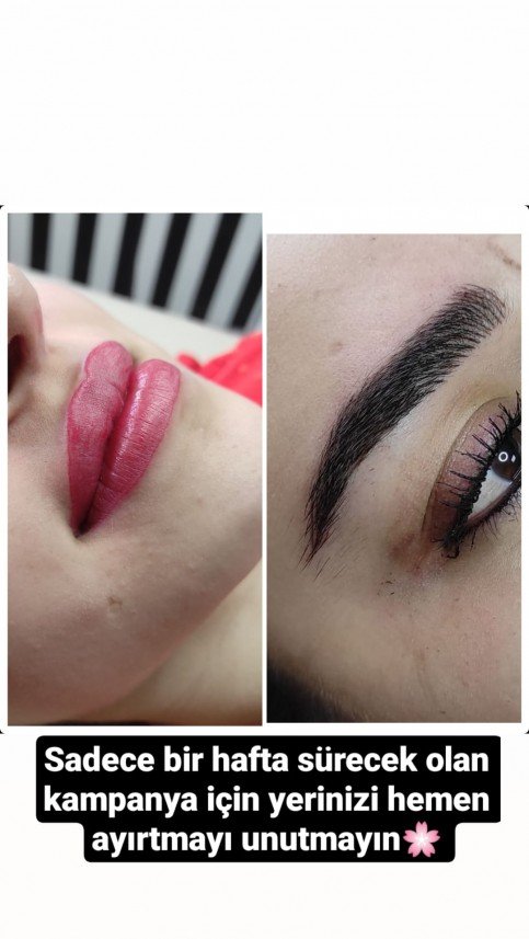 Gaziantep Estetik ve Güzellik