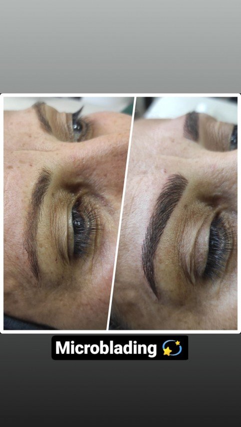 Gaziantep Estetik ve Güzellik