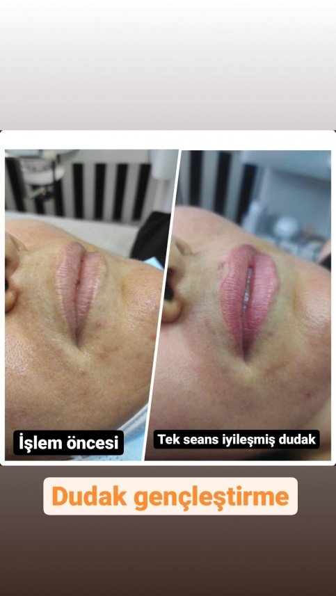 Gaziantep Estetik ve Güzellik