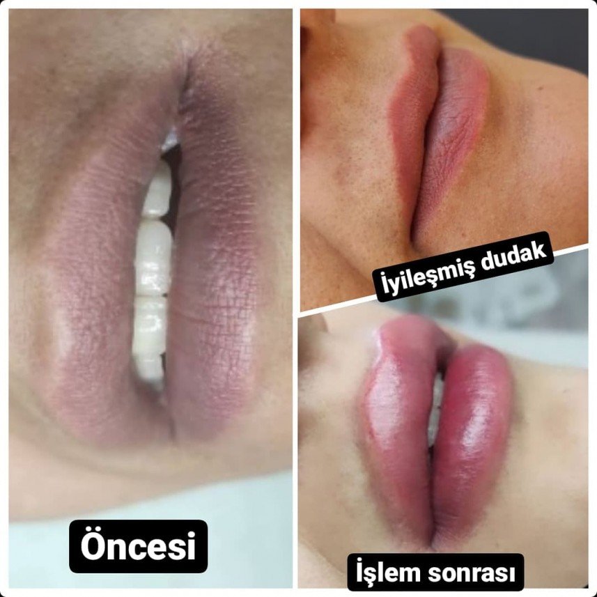 Gaziantep Estetik ve Güzellik