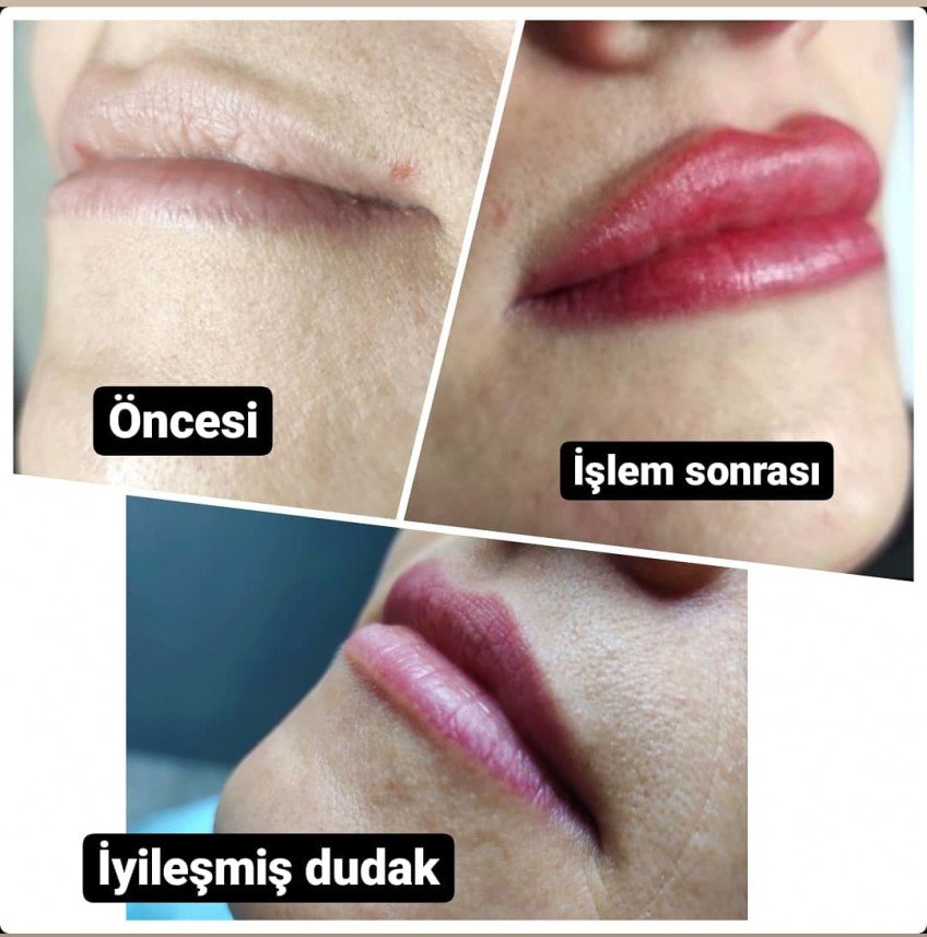 Gaziantep Estetik ve Güzellik