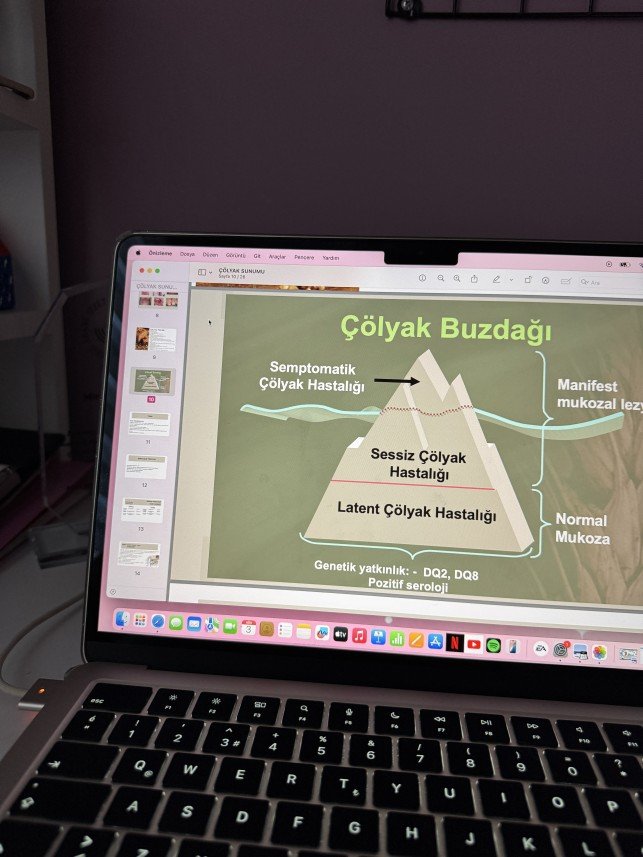 Diyetisyen Miray Cömert