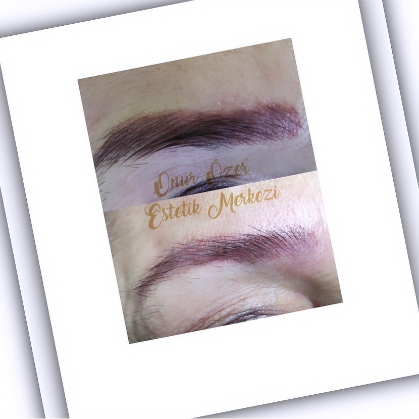 Onur Özer Estetik Merkezi