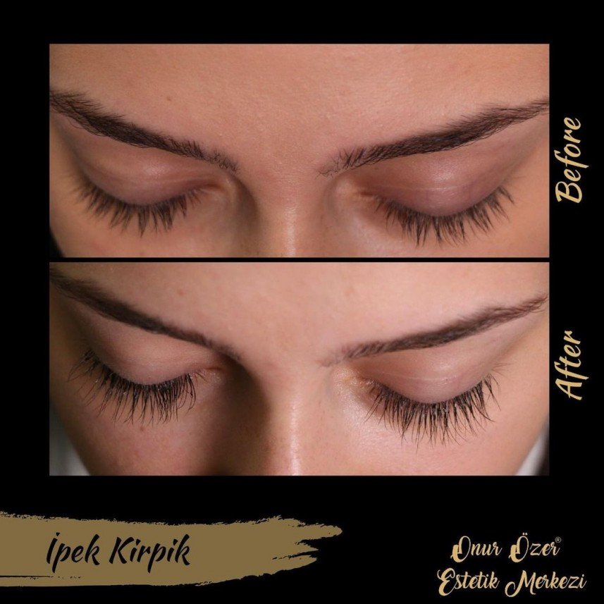 Onur Özer Estetik Merkezi