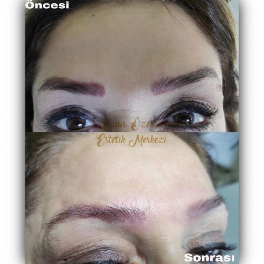 Onur Özer Estetik Merkezi