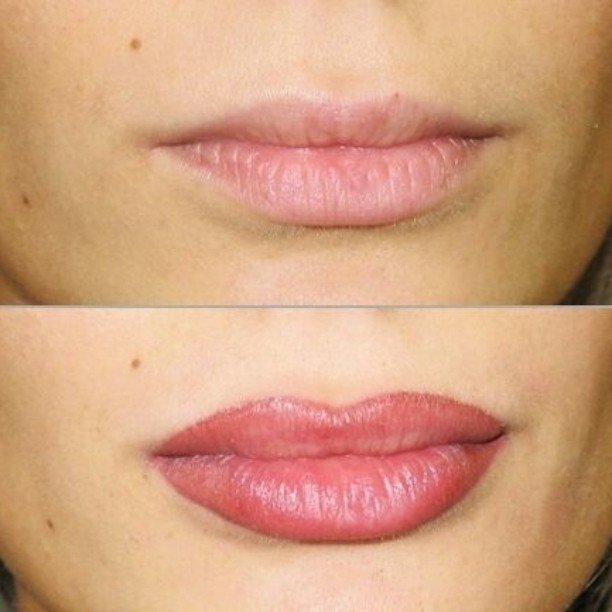 Onur Özer Estetik Merkezi