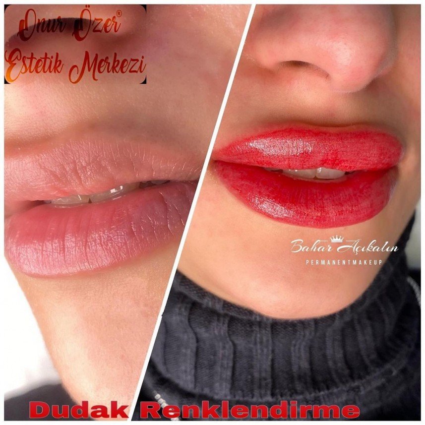 Onur Özer Estetik Merkezi