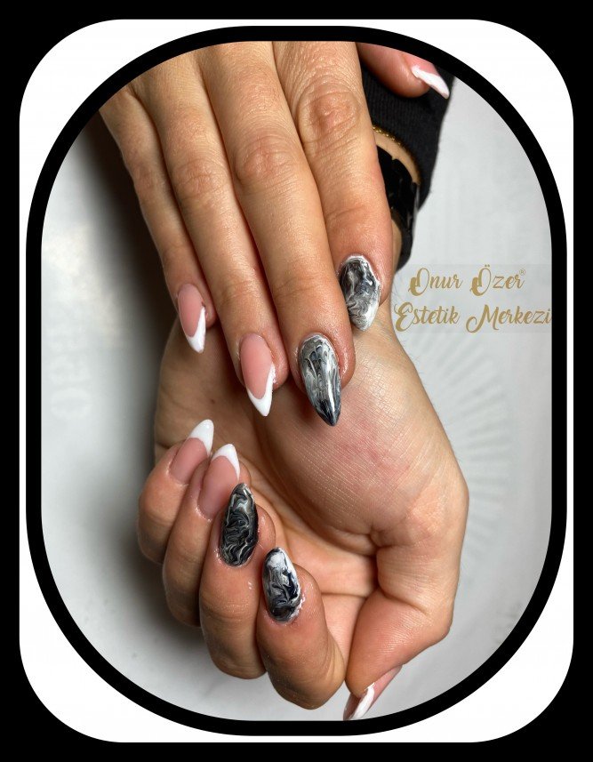 Onur Özer Estetik Merkezi