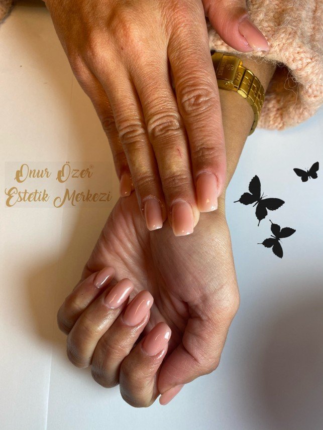 Onur Özer Estetik Merkezi