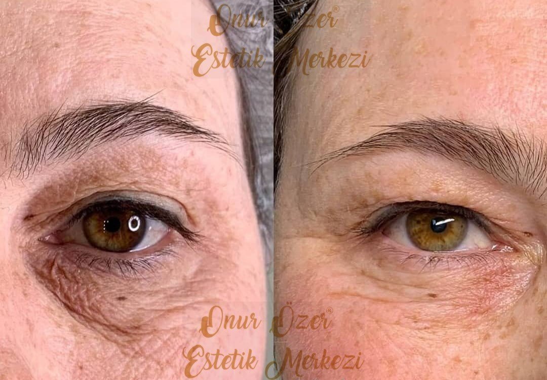Onur Özer Estetik Merkezi