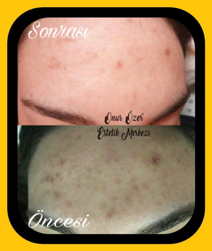 Onur Özer Estetik Merkezi