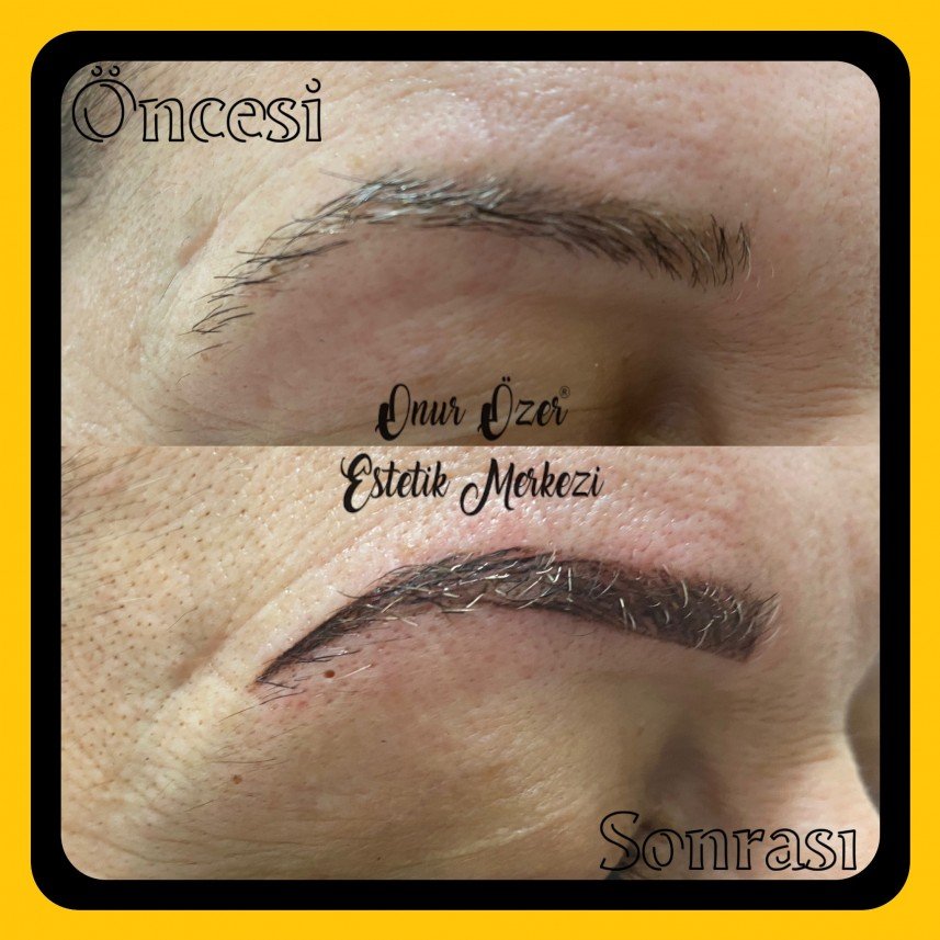 Onur Özer Estetik Merkezi