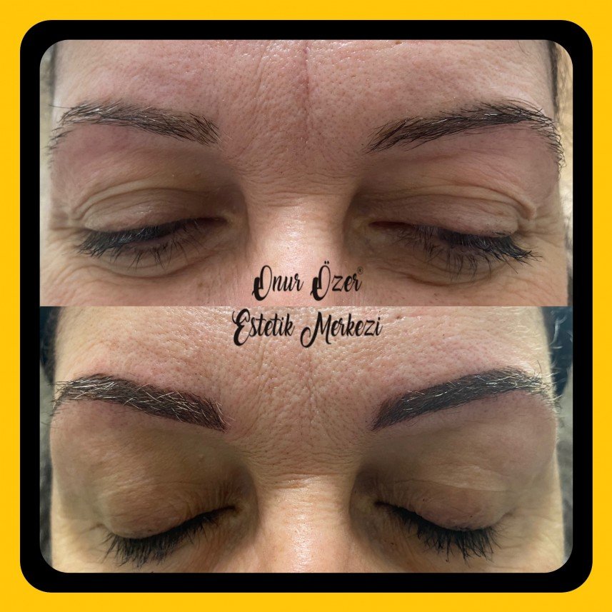 Onur Özer Estetik Merkezi