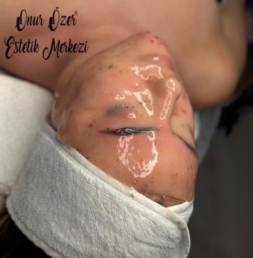 Onur Özer Estetik Merkezi
