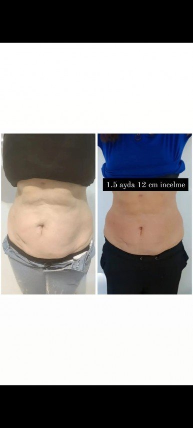 Özge Dilara Karaman