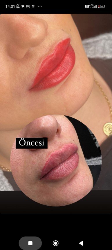 Belleaura Güzellik Merkezi