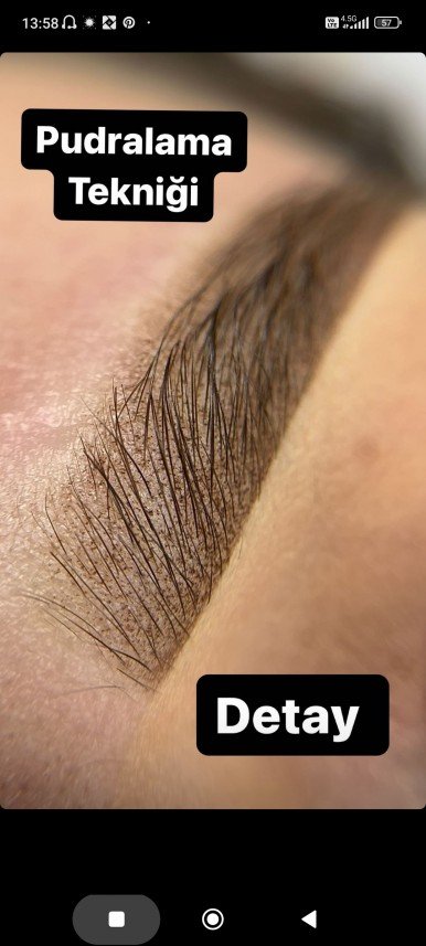 Belleaura Güzellik Merkezi