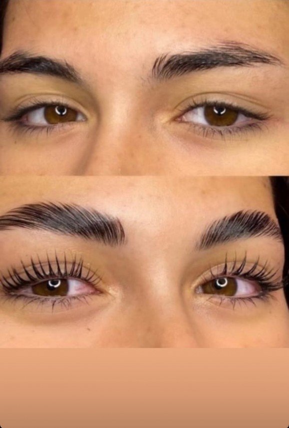 Belleaura Güzellik Merkezi