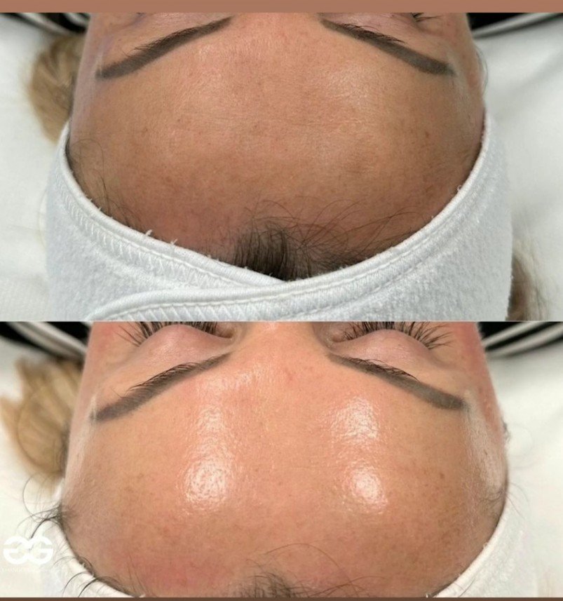 Belleaura Güzellik Merkezi