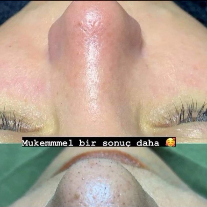 Belleaura Güzellik Merkezi