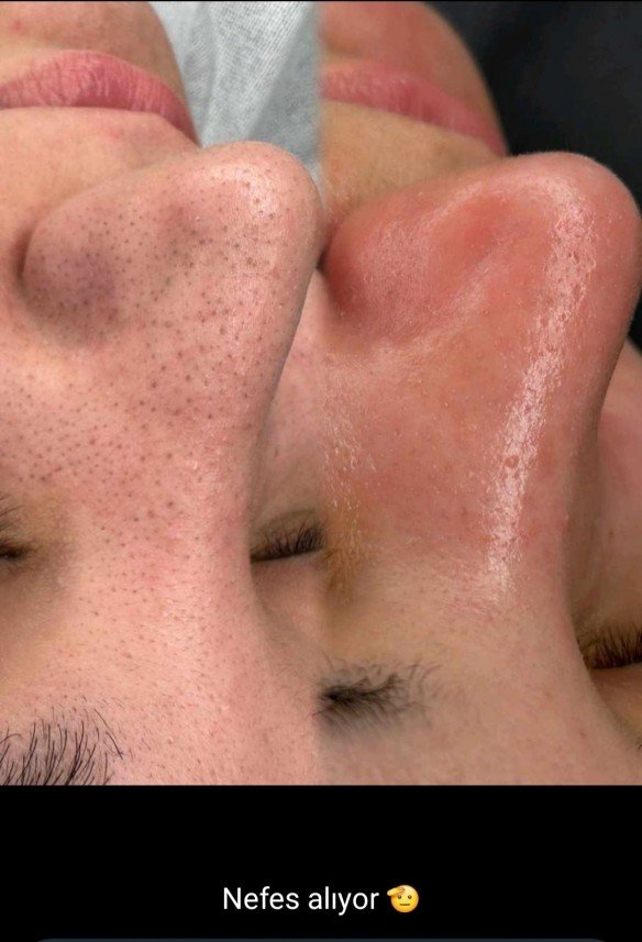 Belleaura Güzellik Merkezi