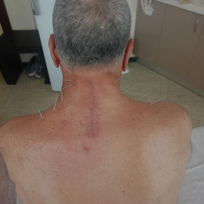 Raşit Kerimzade