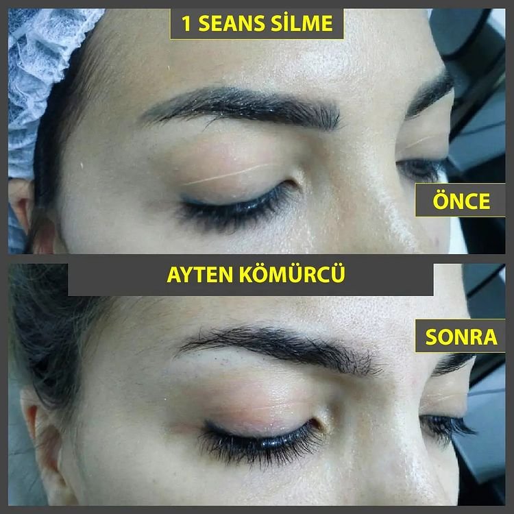 Tanit Estetik Ayten Kömürcü