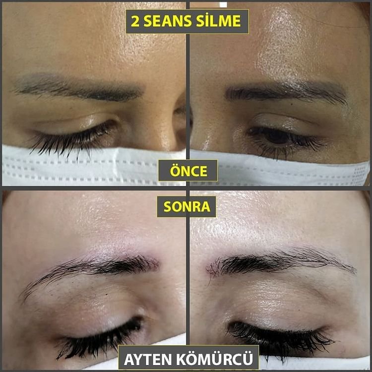 Tanit Estetik Ayten Kömürcü