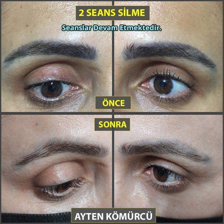 Tanit Estetik Ayten Kömürcü