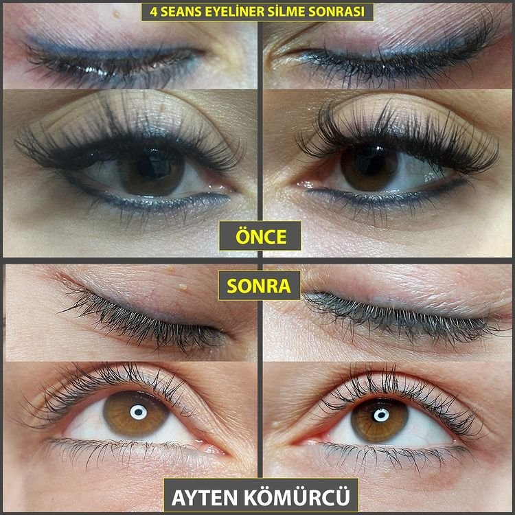 Tanit Estetik Ayten Kömürcü