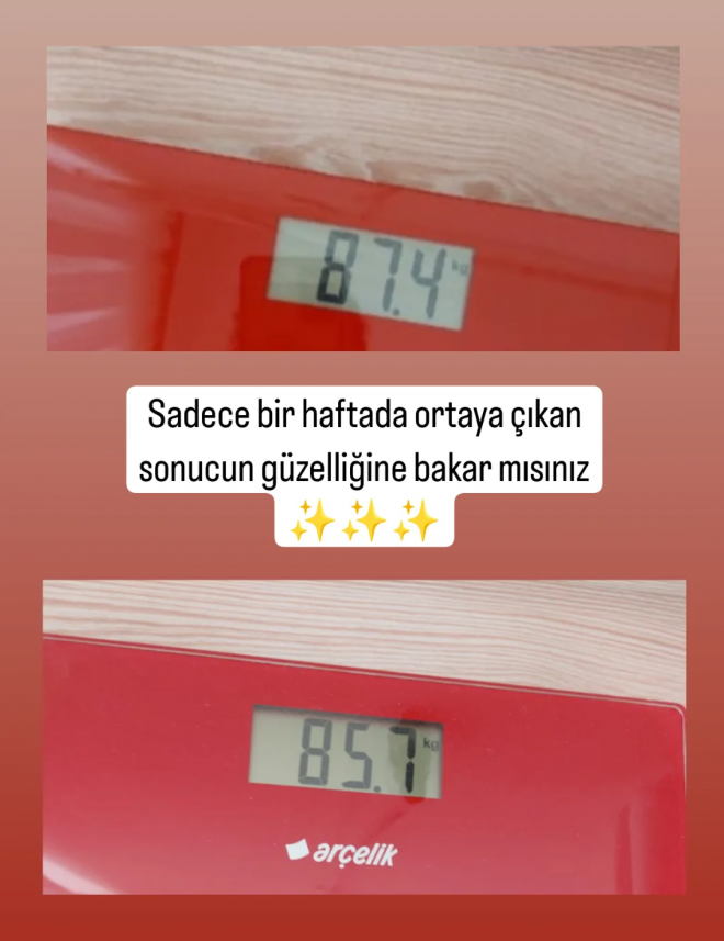 Tuğçe  Toprak