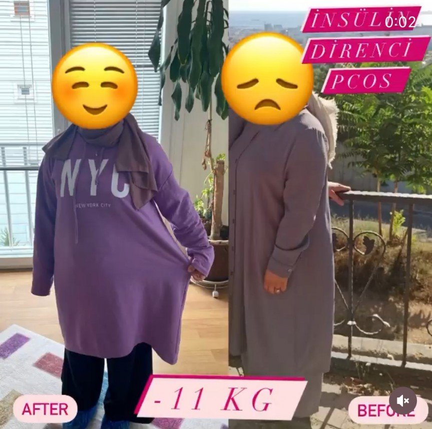 Uzm.Dyt. Özge Ofluoğlu Fidancı