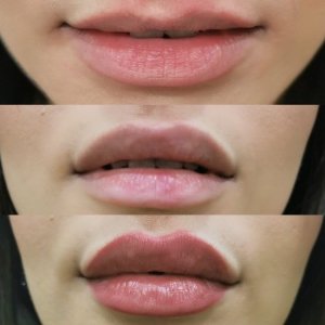 Gaziantep Estetik Ve Güzellik